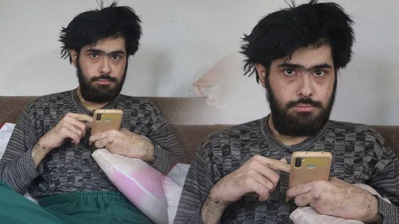 Duş Yok, Tırnak Yok! Bağımlı Genç Şoke Etti