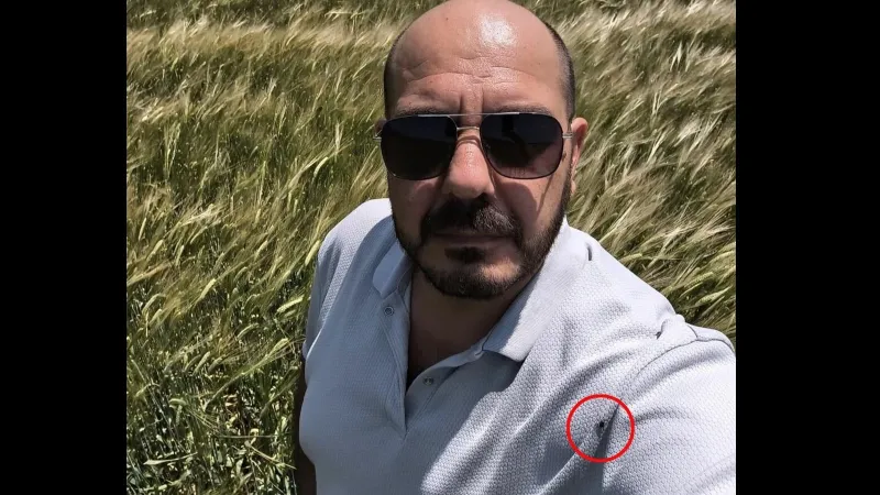 Selfie Çekerken Kene Şoku! Amasyalı Çiftçi Ne Yaptı?
